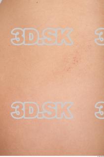 Skin texture of Elvira 0002